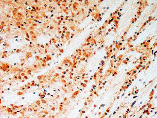 CD38 antibody (AB21-10136) 1-200 in IHC of Rat Brain